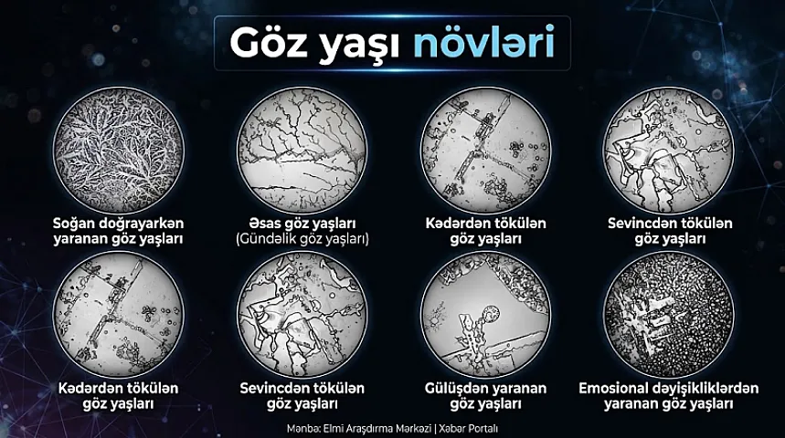 Gözyaşımız həqiqətən hisslərimizə görə dəyişir? – 
