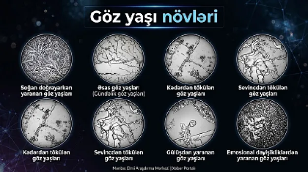 Gözyaşımız həqiqətən hisslərimizə görə dəyişir? – 
