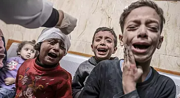 ÜST: Qəzzanın uşaqlarının sağalması daha uzun çəkəcək