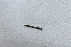 Bakıda azyaşlının mədəsindən mismar çıxarıldı -