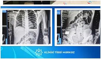 Bakıda 17 yaşlı yeniyetmənin taxta 