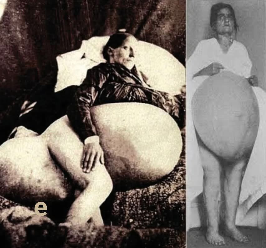 Hamilə olduğunu düşünən qadın ABŞ tibbində tarix yazdı- 