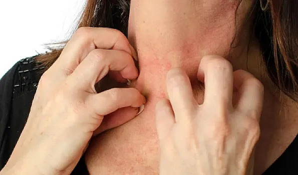 Ən çox hansı qidalar allergiyaya səbəb olur?