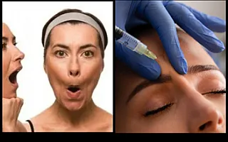 Botoks yoxsa üz idmanı — hansını seçməli?